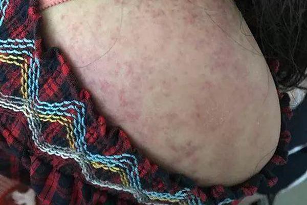 28辆车连环相撞致4死 现场大火燃烧浓烟滚滚_1元挂机宝
