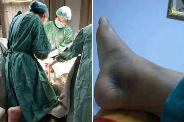 下属经常越级汇报怎么办？用三三二招数，打小人与抬自己一举两得_CN2服务器大内存