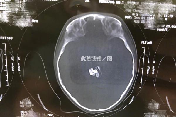 5万的新车却抽到块50万的车牌,车主笑得合不拢嘴_云电脑快照回滚