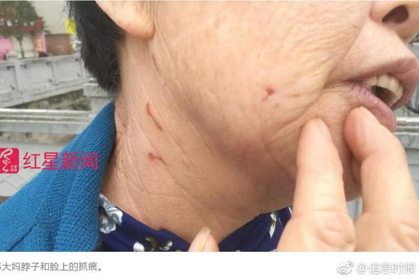“跑路帝”张俭上演汉末版龙门客栈_挂机宝纯净IP