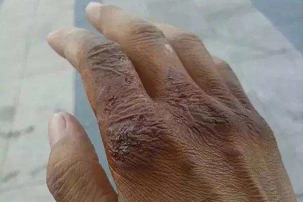 网站和备案域名到期后不再使用应该怎么办？被劫持到博彩网站应该怎么处理？_CN2服务器月付